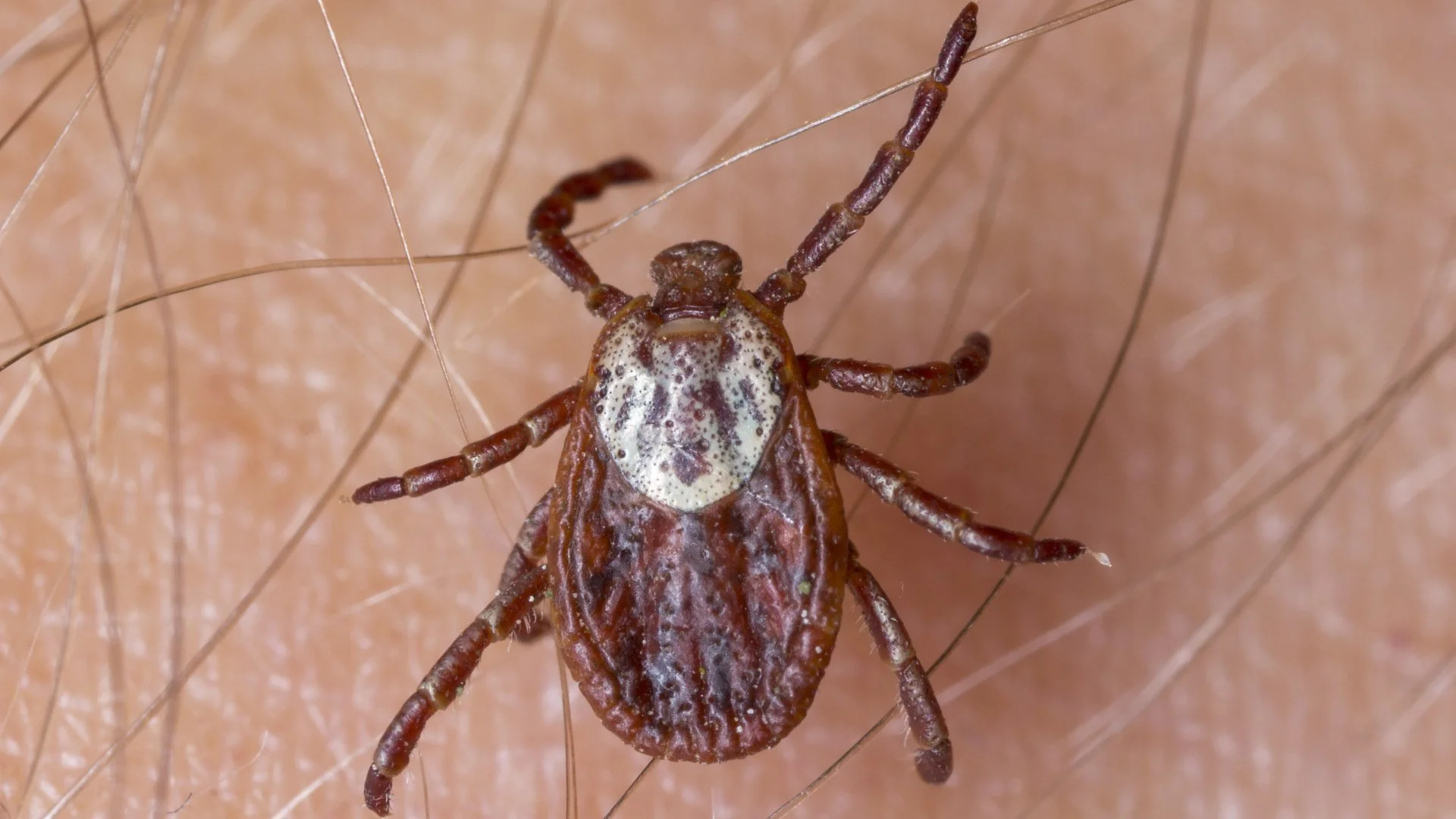 Protect Yourself & Your Kids From Ticks by Doing These 4 Things!